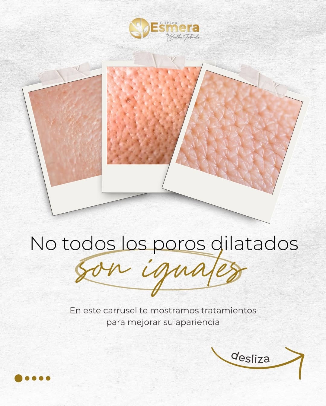 Post 2 by Clínica Esmera | Medicina Estética Madrid on Instagram (carousel)
