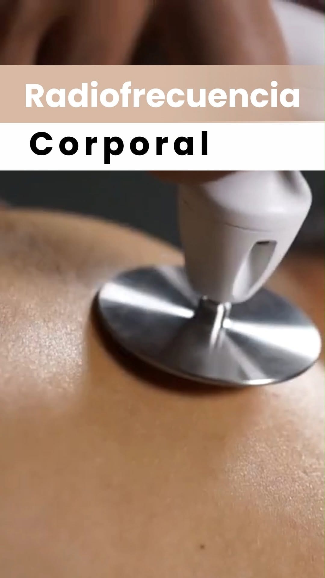 Post 1 by Amamelis Centro MédicoEstético on Instagram (video)
