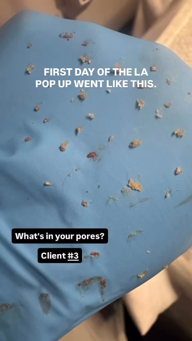 Post 3 by ACNE & CHEMICAL PEEL EXPERT on Instagram (video)