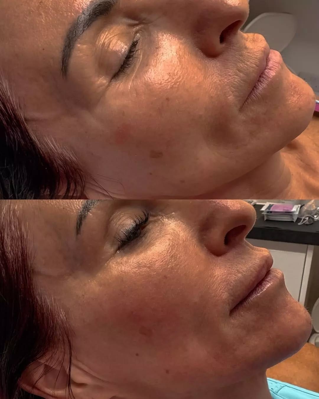 Post 6 by Halo Cosmetics Luxury Aesthetics on Instagram (image)