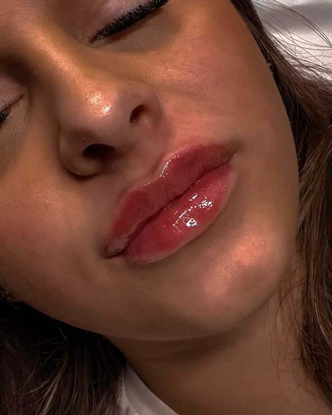 Post 4 by Halo Cosmetics Luxury Aesthetics on Instagram (image)
