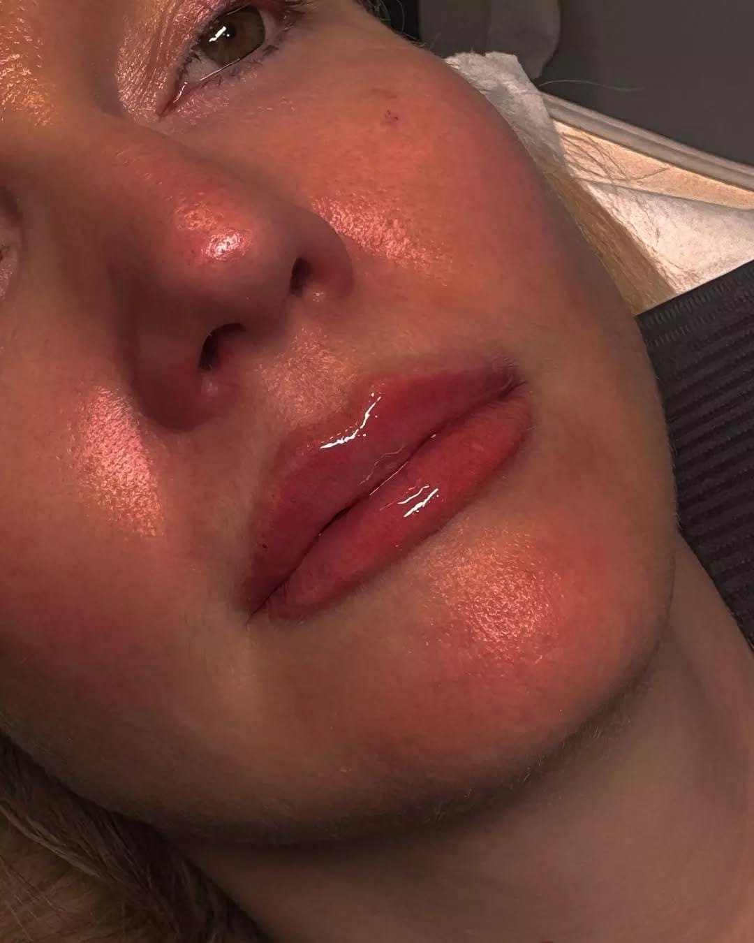 Post 3 by Halo Cosmetics Luxury Aesthetics on Instagram (image)
