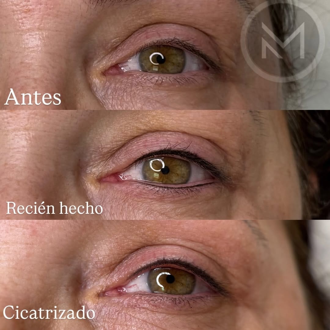 Post 8 by Micropigmentación estética y reparadora || Mónica Aránguez on Instagram (carousel)