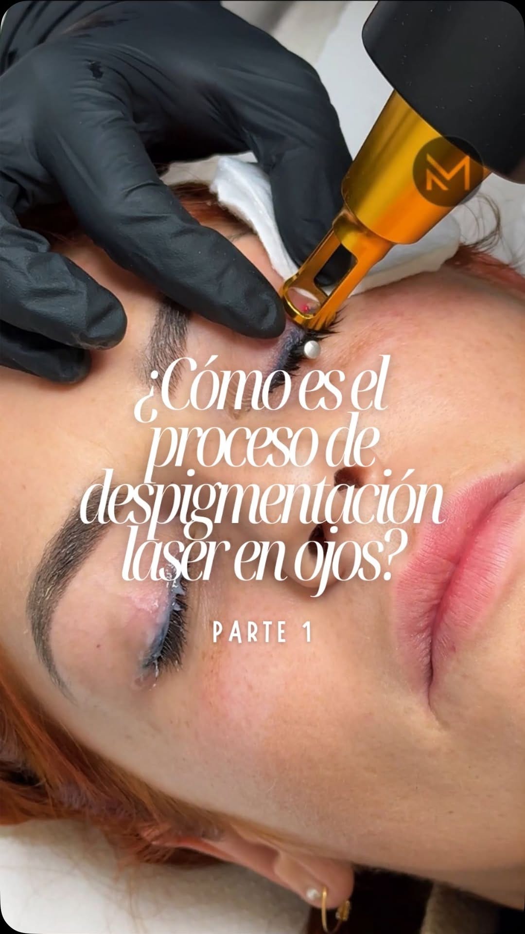 Post 9 by Micropigmentación estética y reparadora || Mónica Aránguez on Instagram (video)
