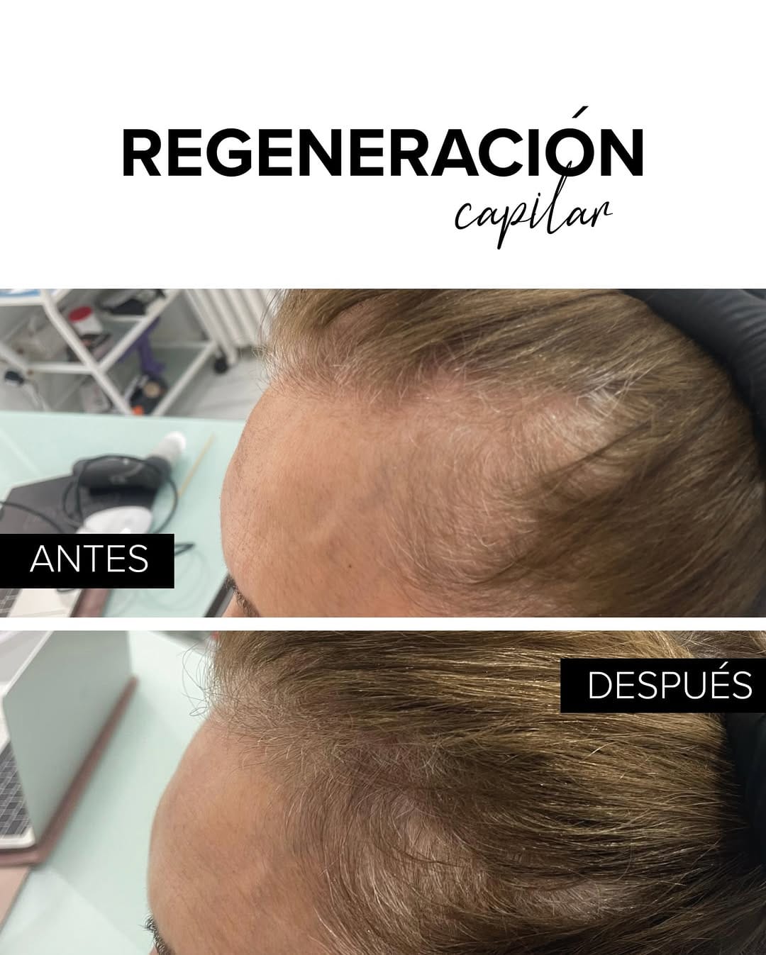 Post 2 by Bojanini Experts España on Instagram (image)