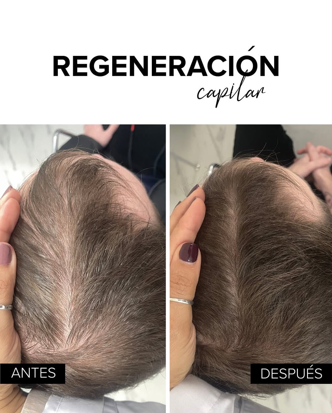 Post 5 by Bojanini Experts España on Instagram (carousel)