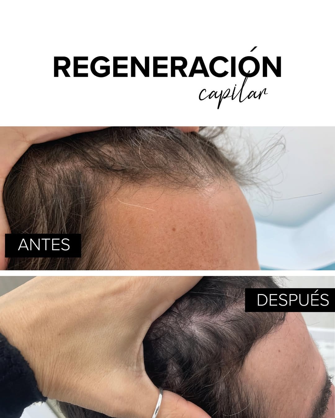 Post 8 by Bojanini Experts España on Instagram (carousel)