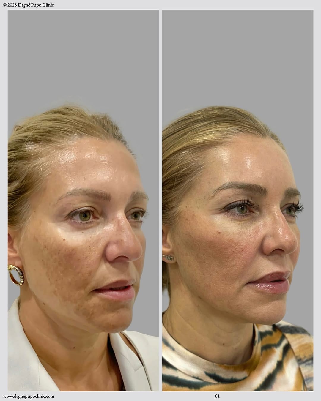 Post 2 by Doctora  Dagné Pupo MD. on Instagram (carousel)