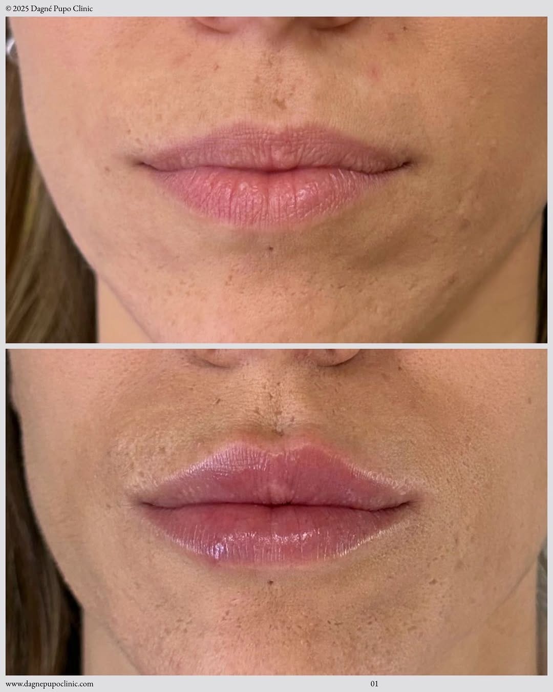 Post 3 by Doctora  Dagné Pupo MD. on Instagram (carousel)
