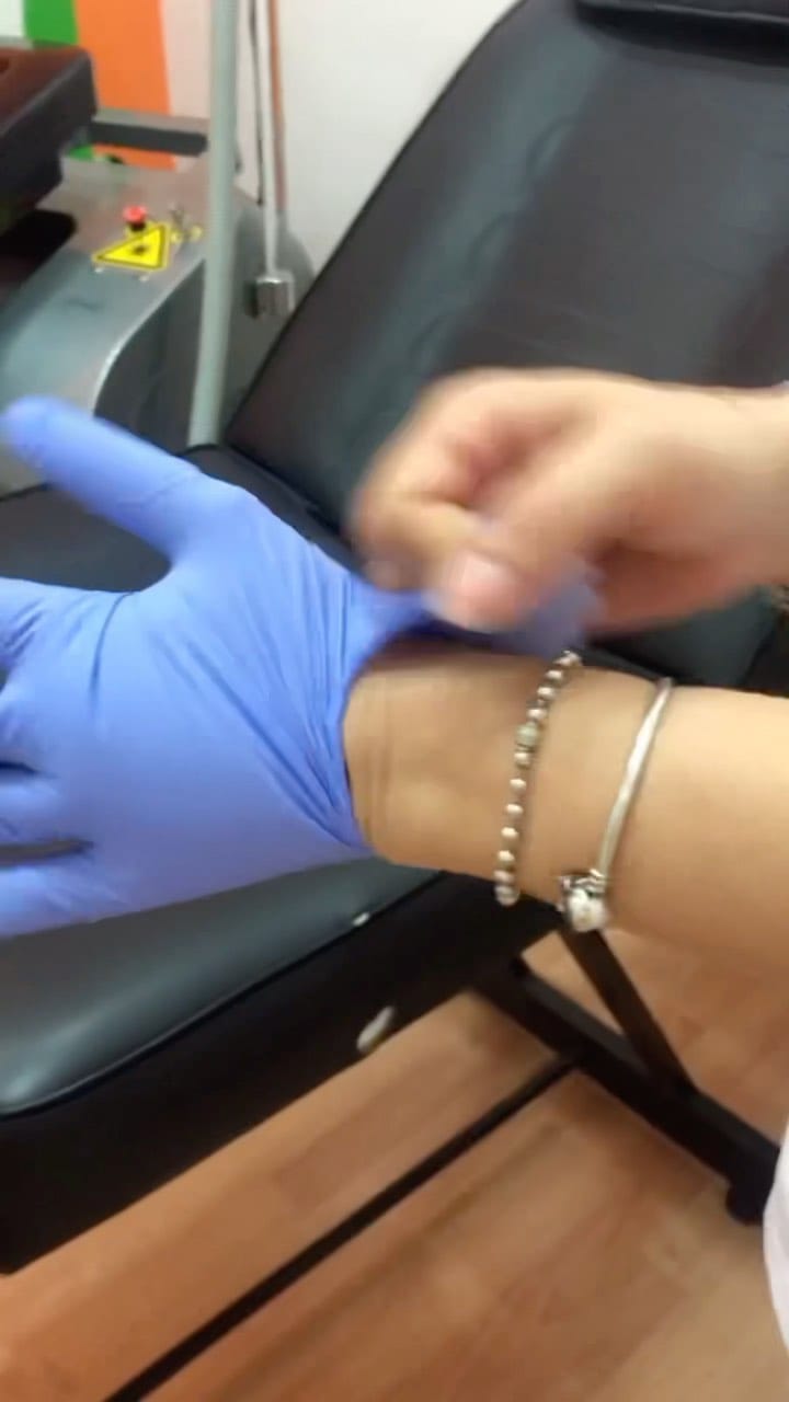 Post 9 by ST-Laser on Instagram (video)