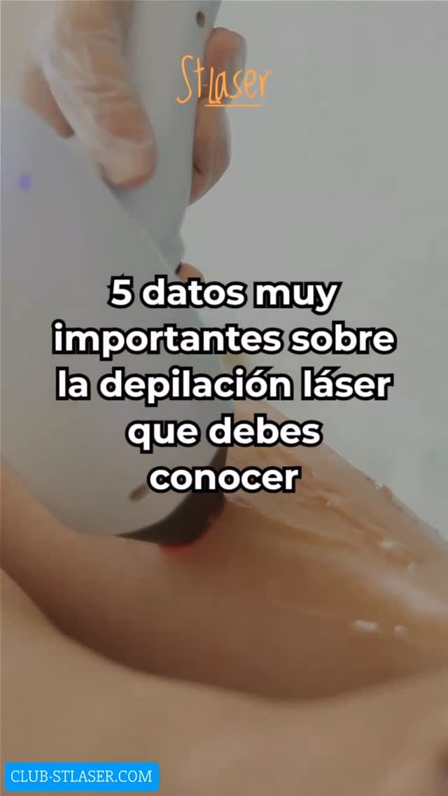 Post 1 by ST-Laser on Instagram (video)