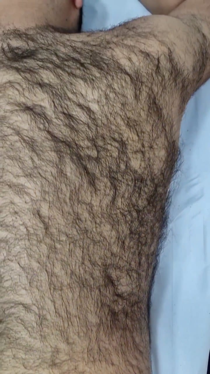 Post 10 by ST-Laser on Instagram (video)