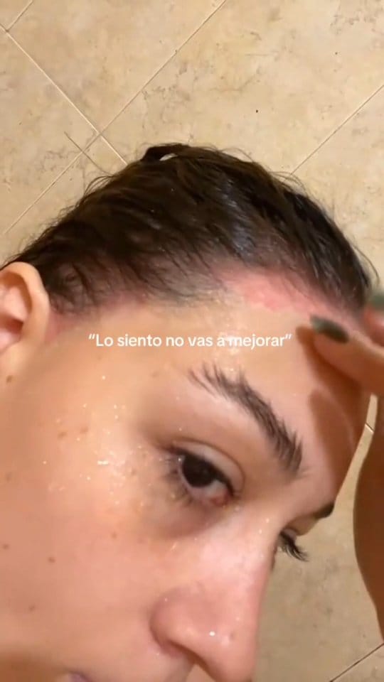 Post 8 by Siempre Joven | Skin Care🇻🇪 on Instagram (video)