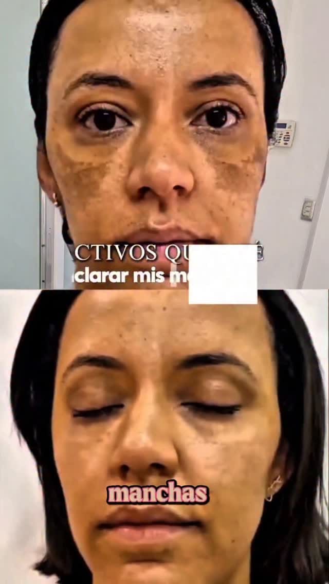 Post 4 by Siempre Joven | Skin Care🇻🇪 on Instagram (video)