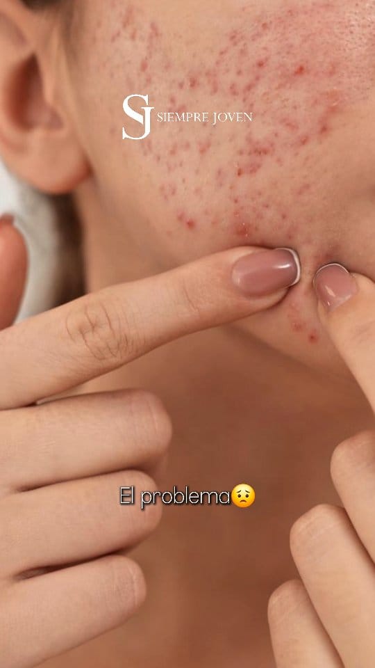 Post 7 by Siempre Joven | Skin Care🇻🇪 on Instagram (video)