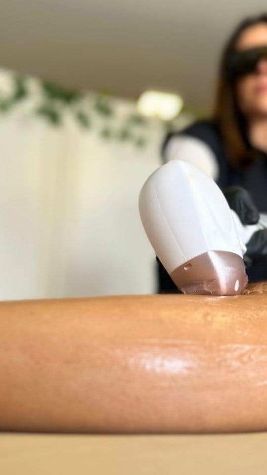 Post 8 by Estetica Facial | Corporal & Depilación Definitiva on Instagram (video)