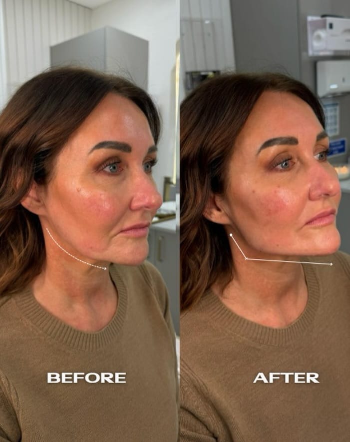 Post 6 by PURAGLOW COSMETICS & ACADEMY 🎓 on Instagram (image)