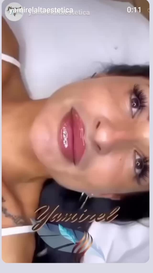 Post 7 by Yamirel Alta Estética | Medicina Estética on Instagram (video)