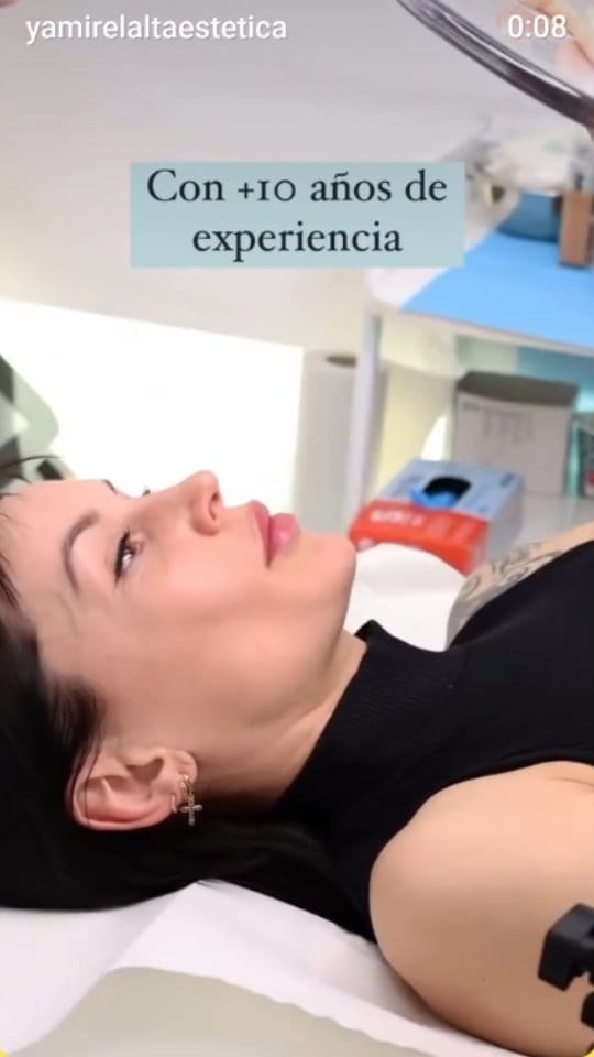 Post 1 by Yamirel Alta Estética | Medicina Estética on Instagram (video)