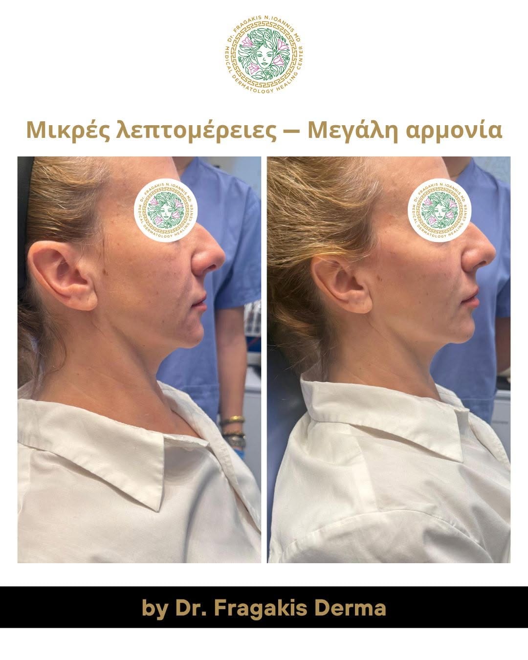 Post 9 by Dr. Fragakis | Δερματολόγος Αφροδισιολόγος MD,MSC on Instagram (carousel)