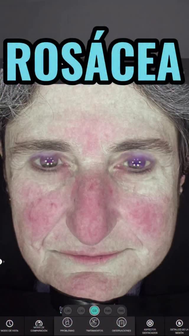 Post 3 by Hakari Clinics on Instagram (video)