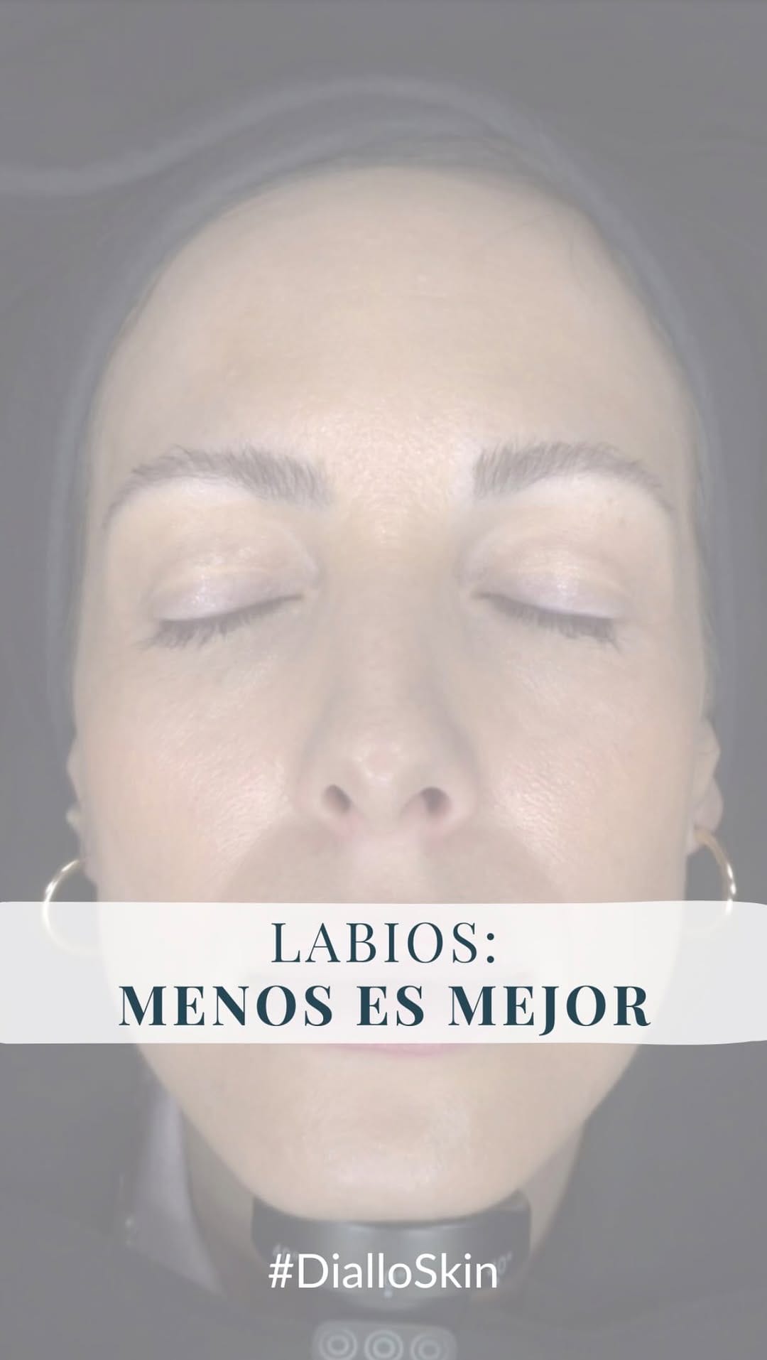 Post 2 by Hakari Clinics on Instagram (video)