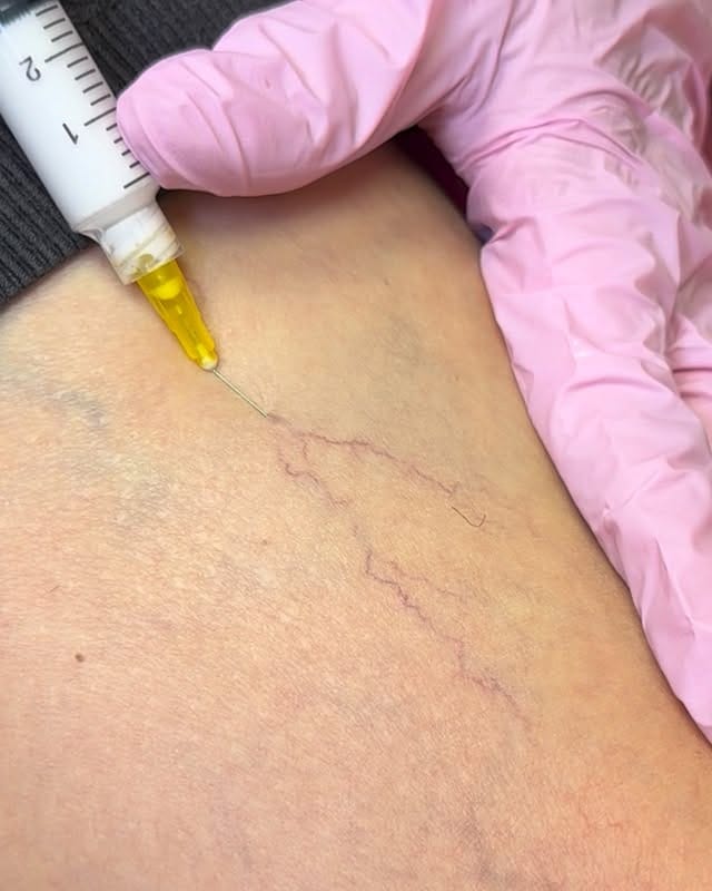 Post 7 by Clínica Ferran Solà. Cirugía y Medicina Estética on Instagram (video)