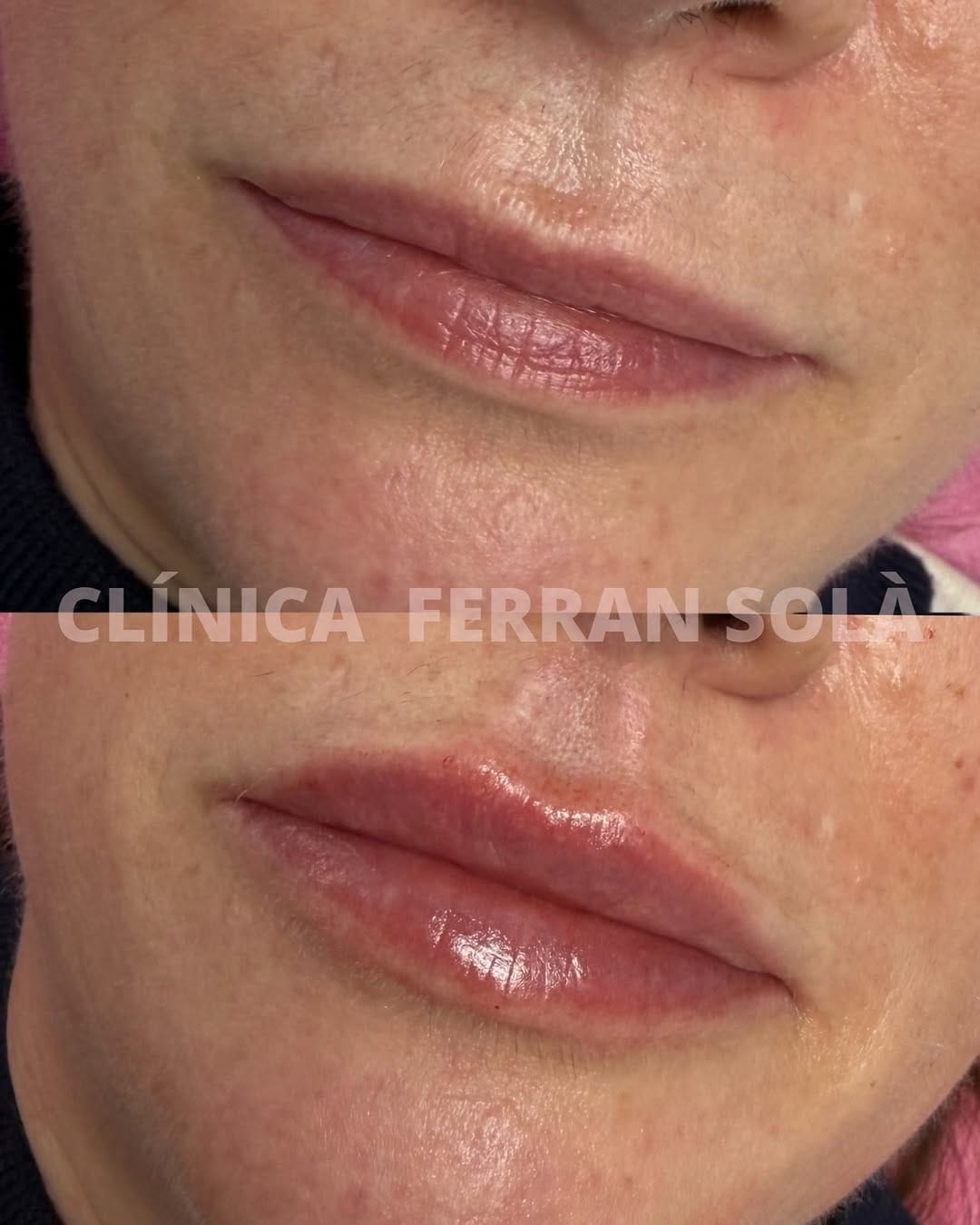 Post 1 by Clínica Ferran Solà. Cirugía y Medicina Estética on Instagram (image)