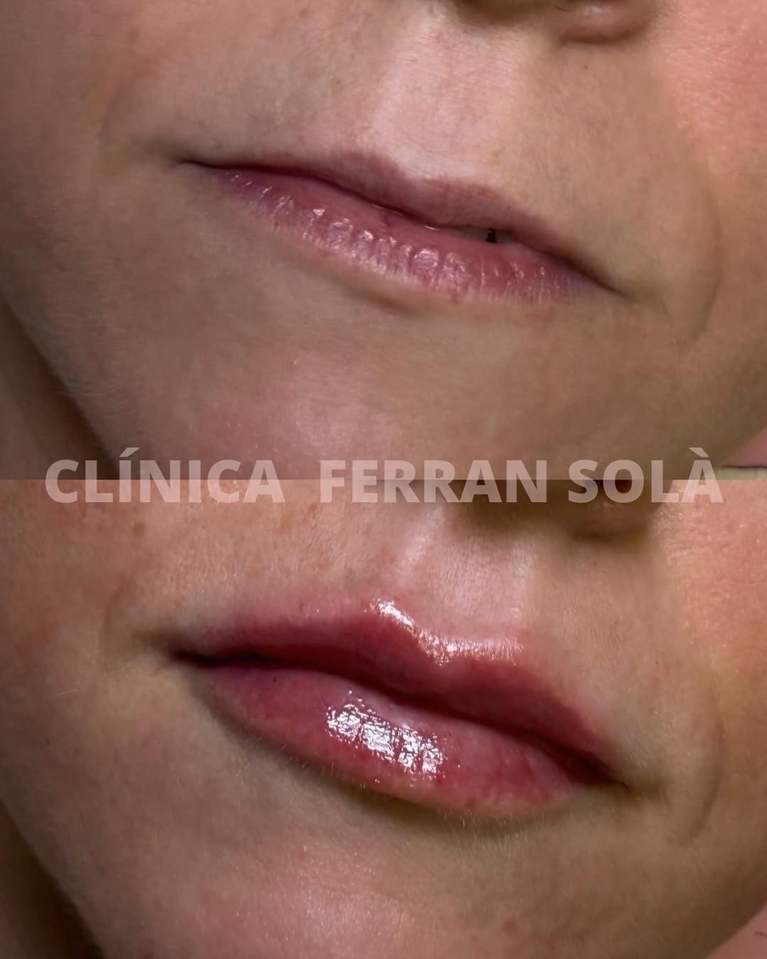 Post 2 by Clínica Ferran Solà. Cirugía y Medicina Estética on Instagram (image)