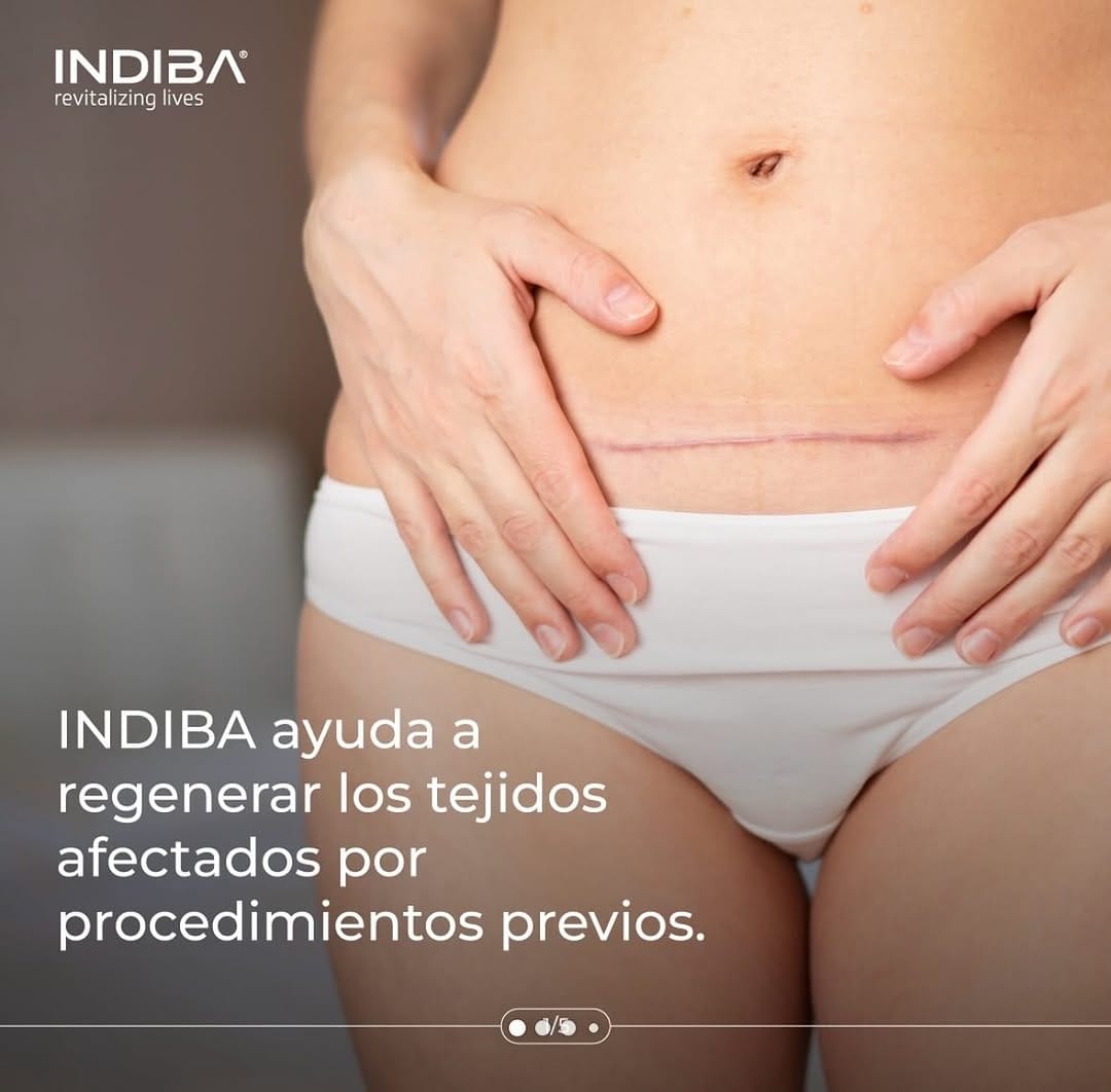 Post 9 by Martbella Laser Clinic | Clínica Medicina Estética | Murcia on Instagram (carousel)