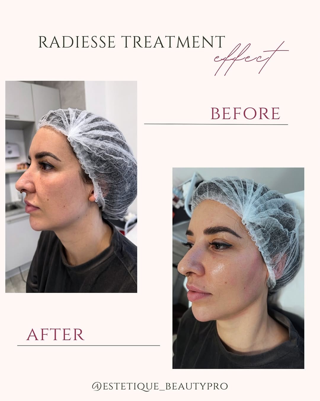 Post 8 by IKP Estetique on Instagram (image)