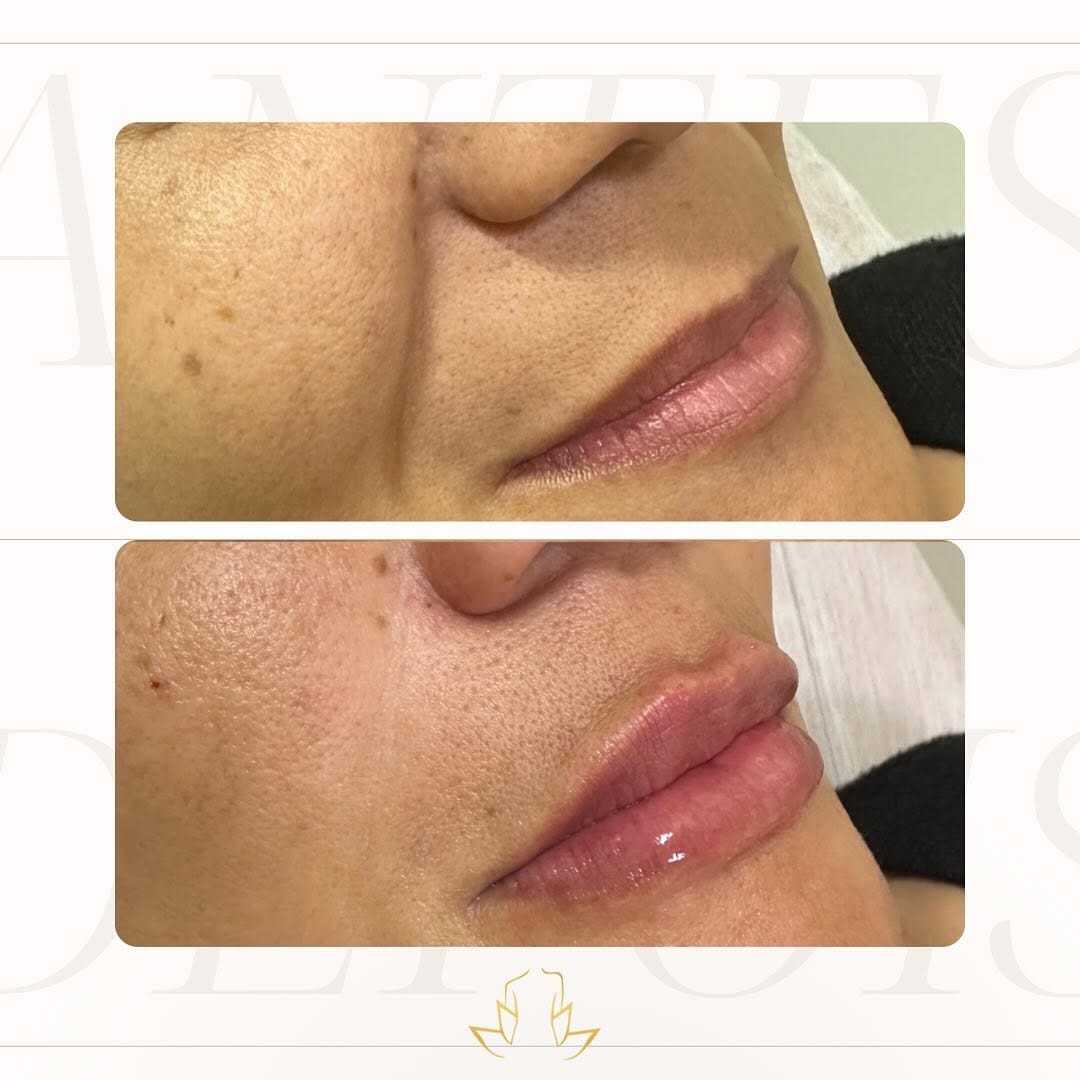 Post 8 by Bruna Tatagiba ❄️ CRIOMODELAGEM ♡ Estética Avançada on Instagram (image)
