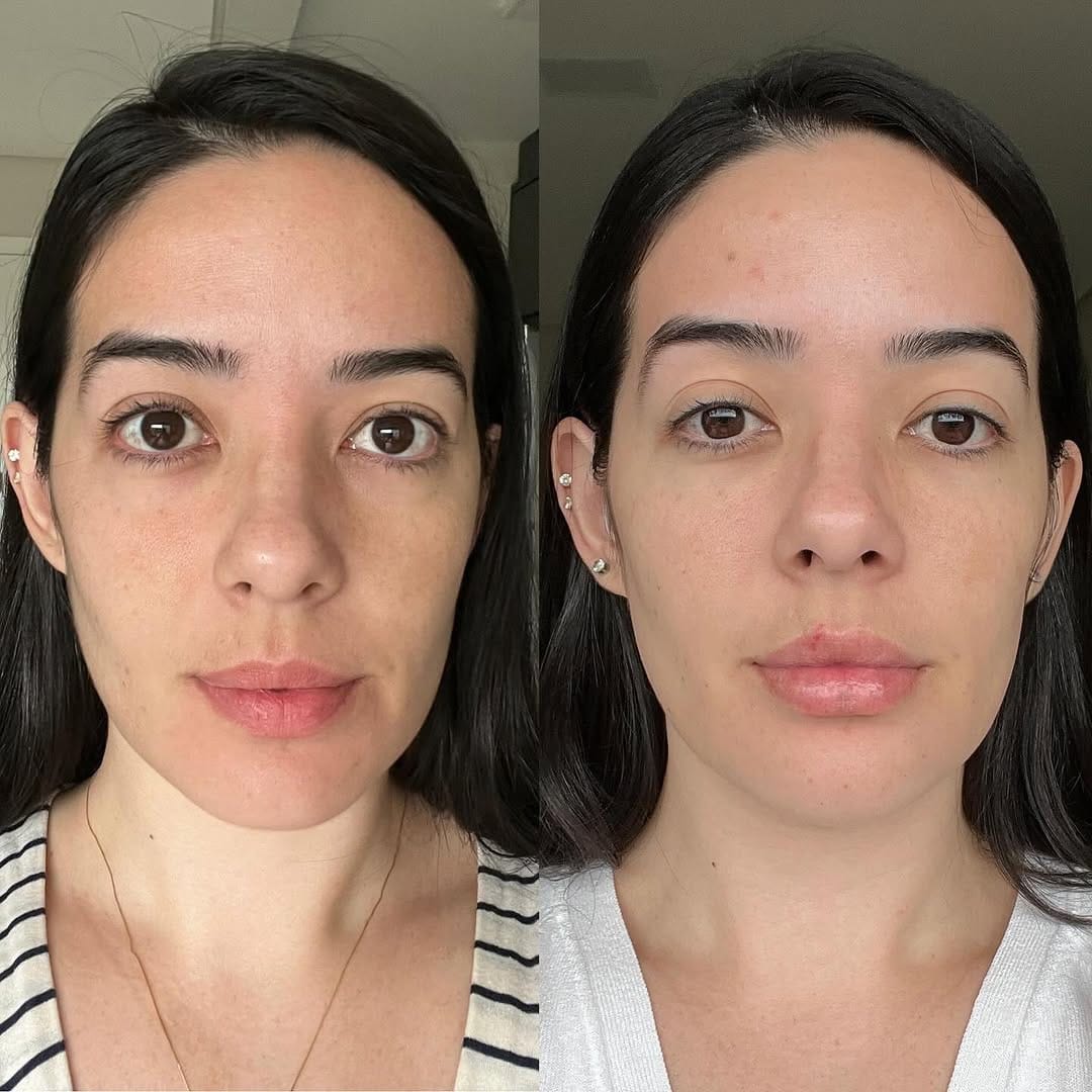 Post 10 by Bruna Tatagiba ❄️ CRIOMODELAGEM ♡ Estética Avançada on Instagram (carousel)