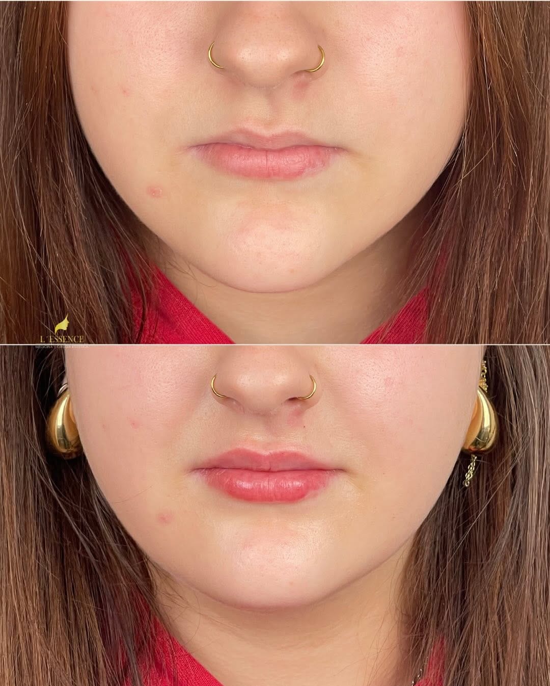 Post 8 by L'ESSENCE MEDICINA ESTÉTICA 👄 on Instagram (carousel)