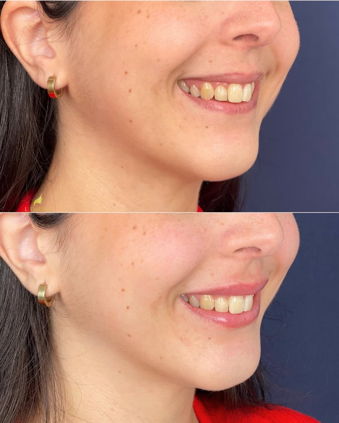Post 2 by L'ESSENCE MEDICINA ESTÉTICA 👄 on Instagram (carousel)