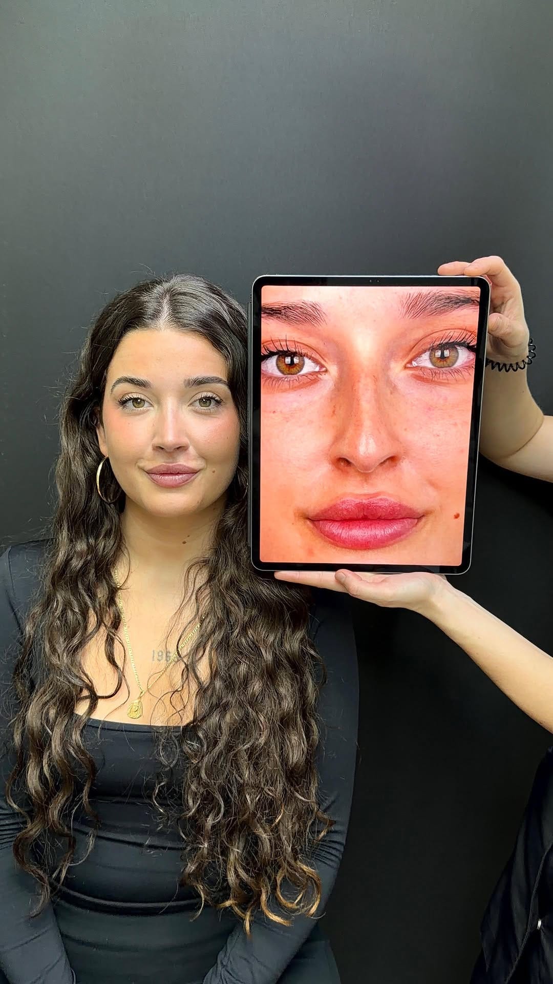 Post 4 by L'ESSENCE MEDICINA ESTÉTICA 👄 on Instagram (video)