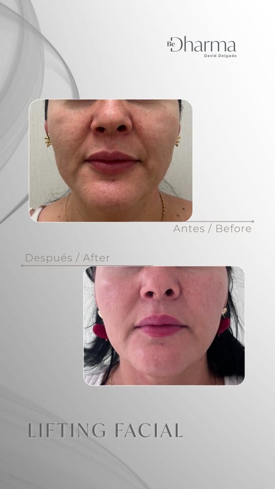 Post 2 by Clínica Be Dharma | Clínica de Estética Medellín on Instagram (video)