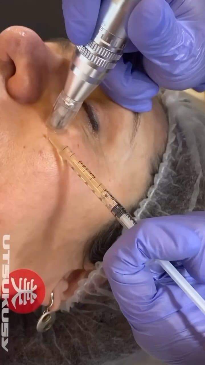 Post 9 by Aqua Laser Sculpt | Estética Avanzada on Instagram (video)