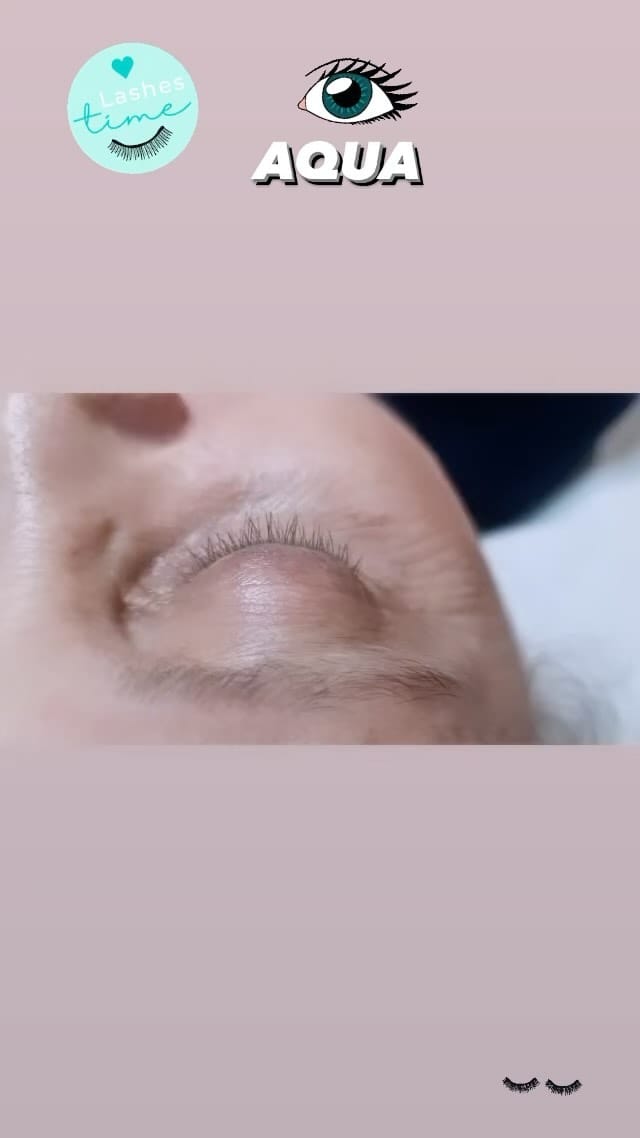 Post 6 by Aqua Laser Sculpt | Estética Avanzada on Instagram (video)