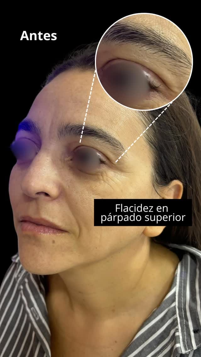 Post 10 by Estética Integral on Instagram (video)