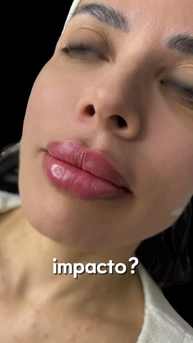 Post 5 by Estética Integral on Instagram (video)