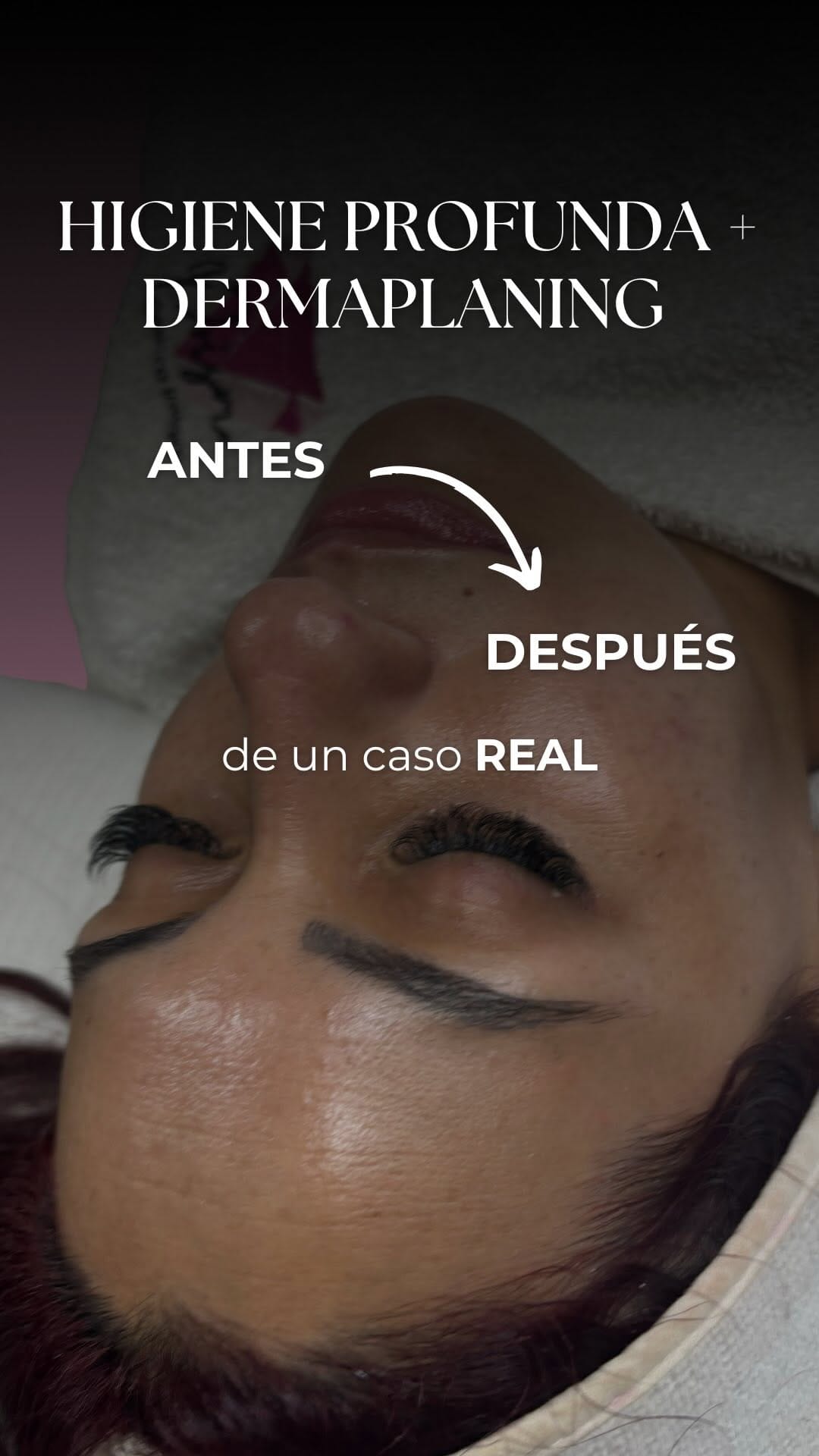 Post 3 by Estética Integral on Instagram (video)