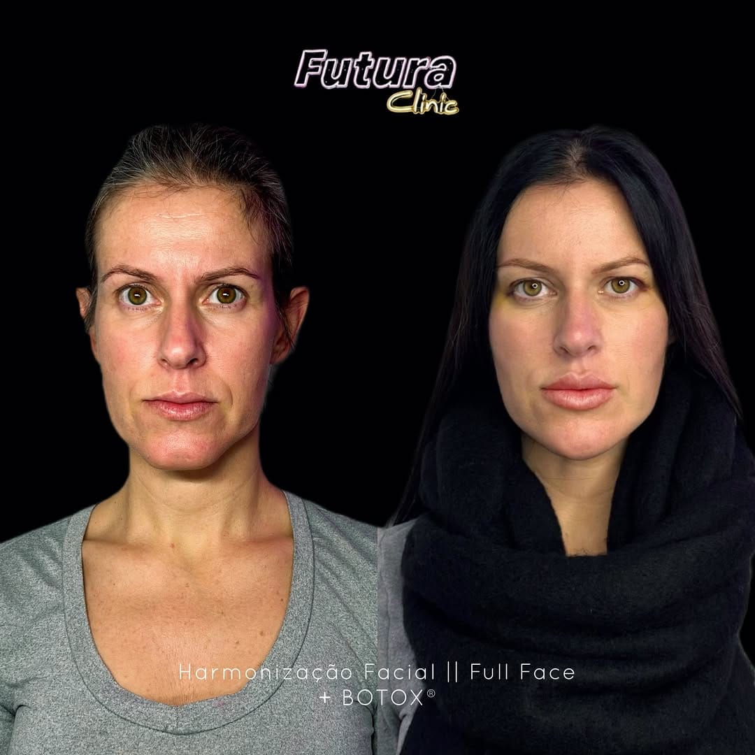 Post 4 by FUTURA® Clinic Porto 🇵🇹 on Instagram (image)
