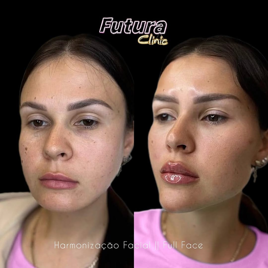 Post 7 by FUTURA® Clinic Porto 🇵🇹 on Instagram (image)