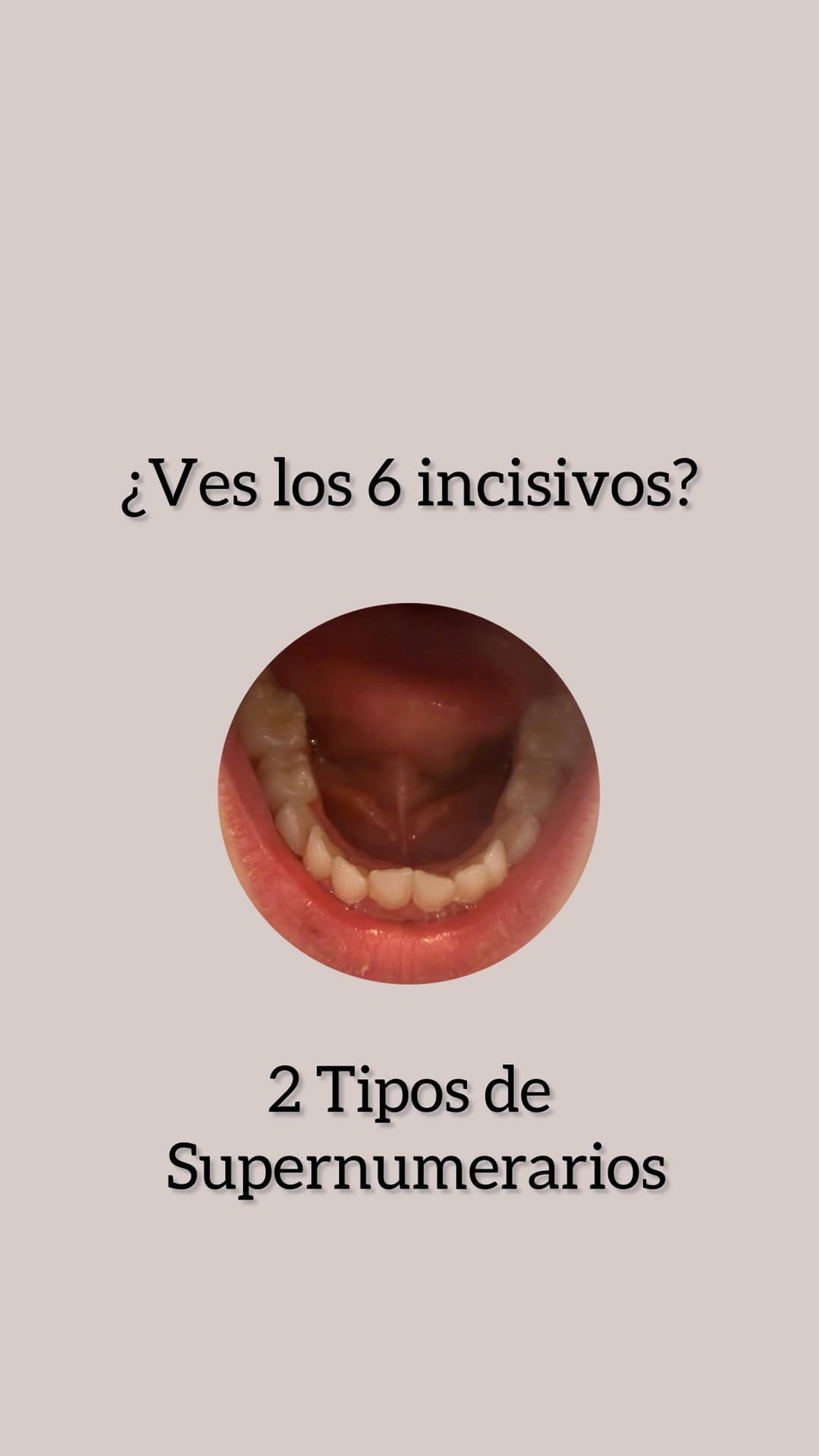 Post 2 by Dra María Fdez de la Puente on Instagram (video)