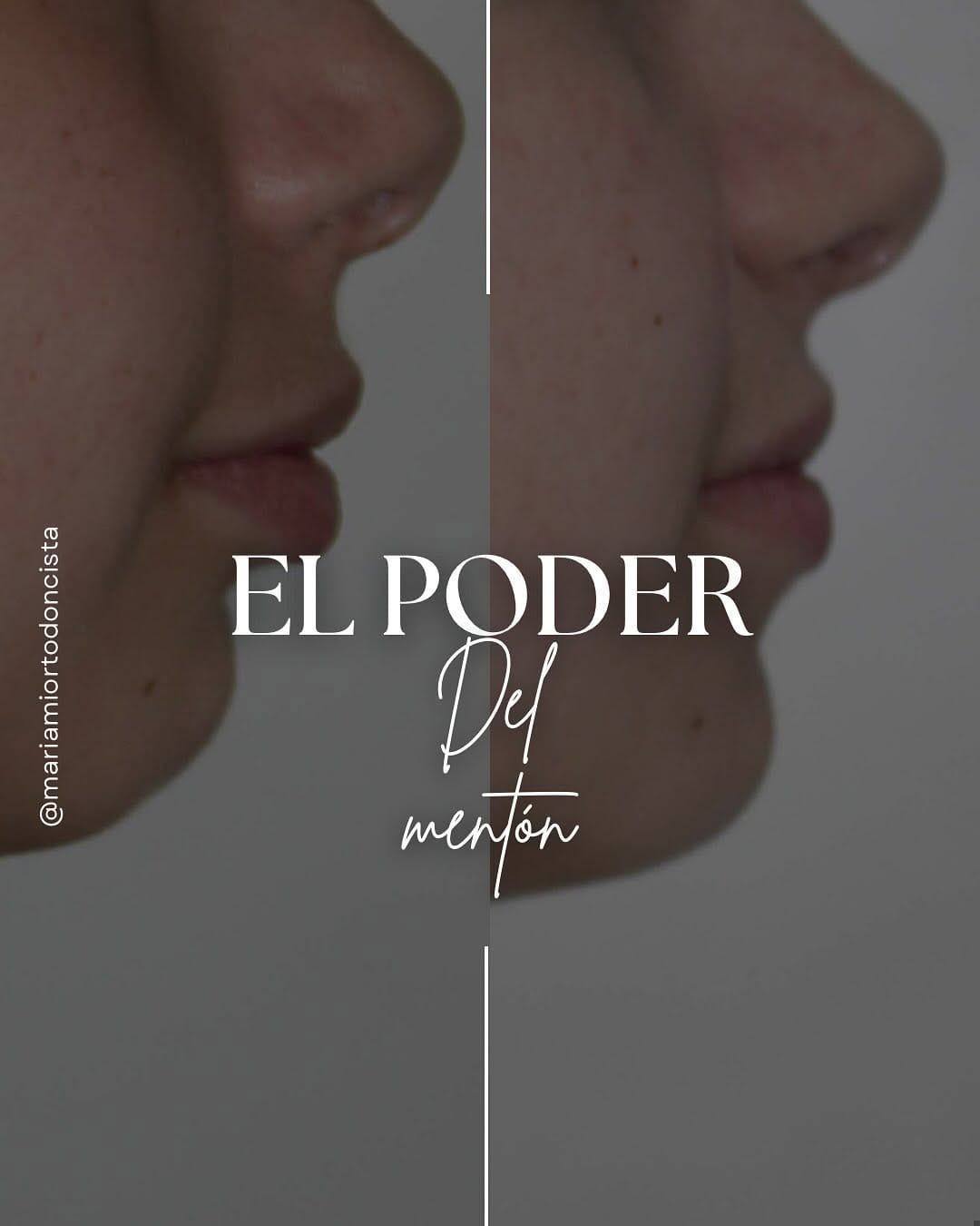 Post 7 by Dra María Fdez de la Puente on Instagram (carousel)