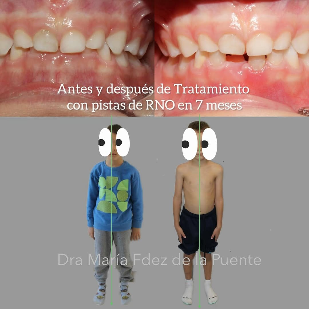 Post 5 by Dra María Fdez de la Puente on Instagram (carousel)