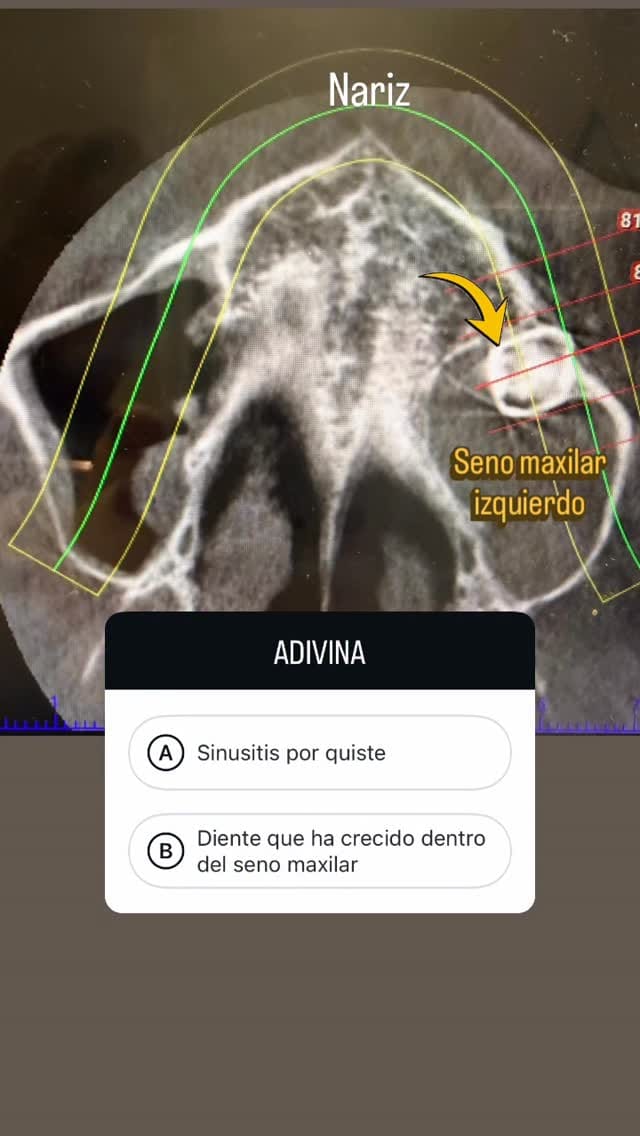 Post 1 by Dra María Fdez de la Puente on Instagram (video)