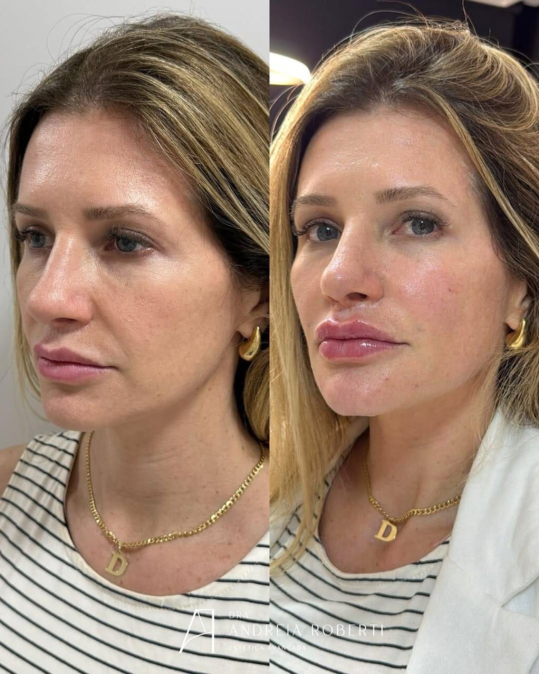 Post 10 by Dra. Andréia Roberti - Harmonização Facial on Instagram (image)