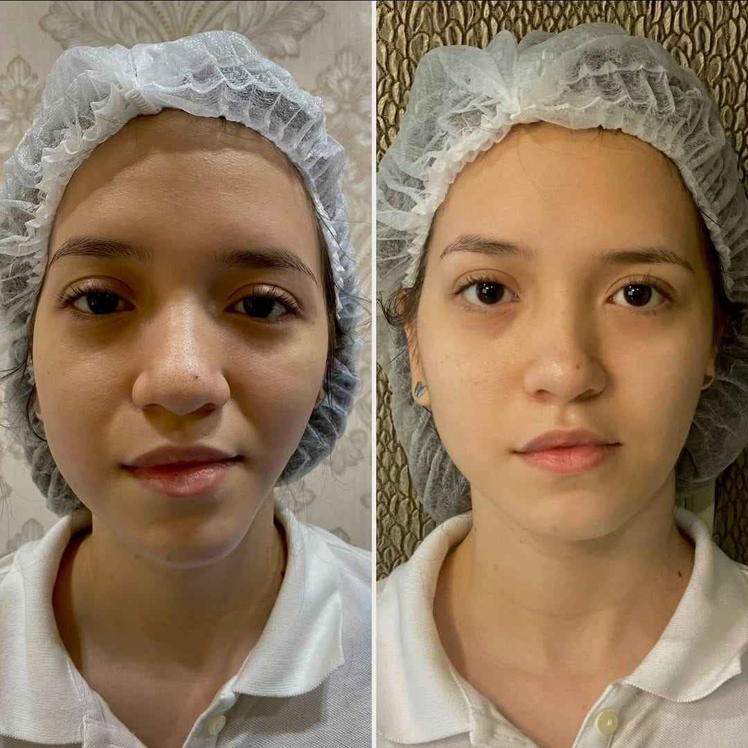 Post 2 by Dr Jusueth Morán on Instagram (carousel)